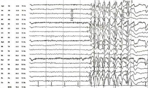 EEG Graph
